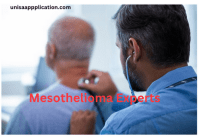 Mesothelioma Experts